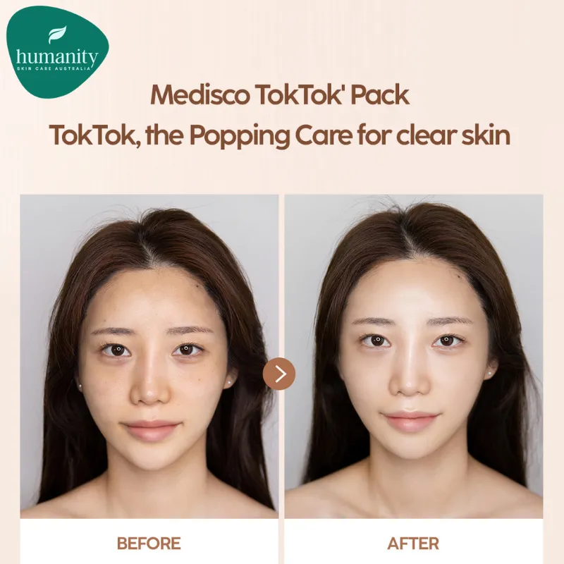 MEDISCO TokTok Pack - Co2 Carboxy Therapy - 5pk